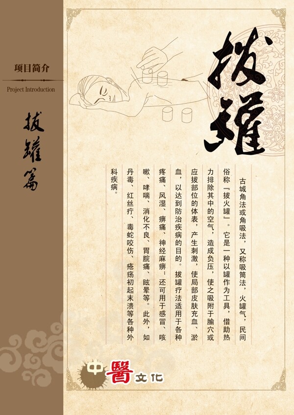 項目簡介拔罐