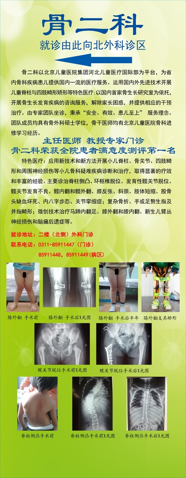骨科展架