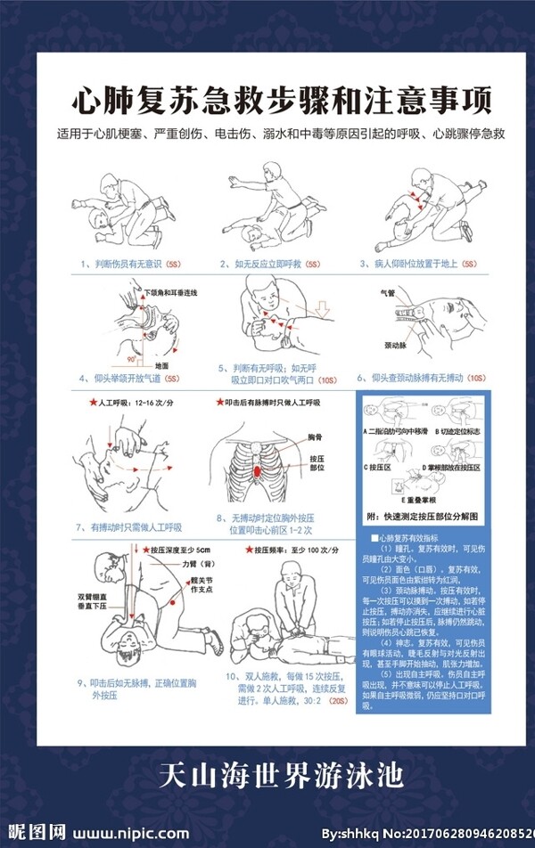 心肺复苏