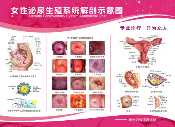 女性泌尿生殖系统解剖示意图
