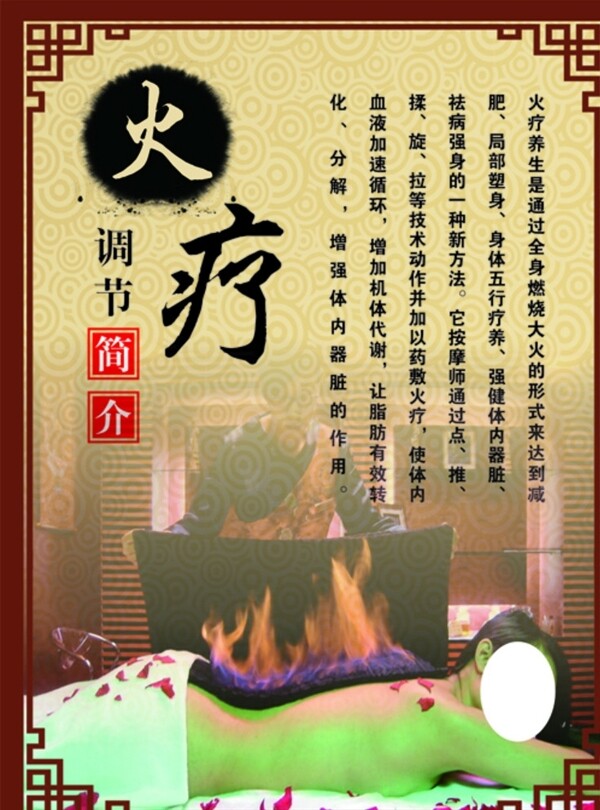 養(yǎng)生文化之火療