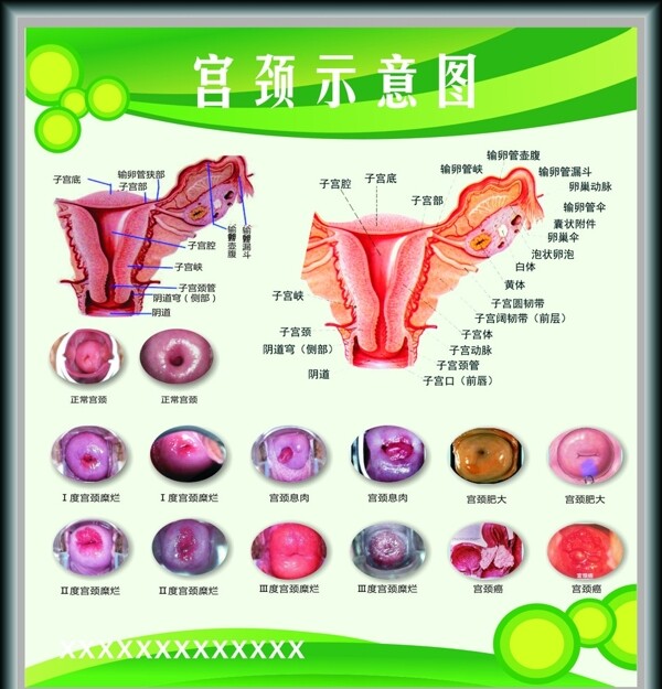 子宮宮頸