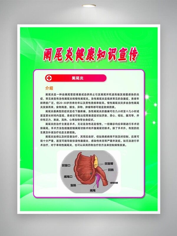 闌尾炎健康知識(shí)宣傳海報(bào)