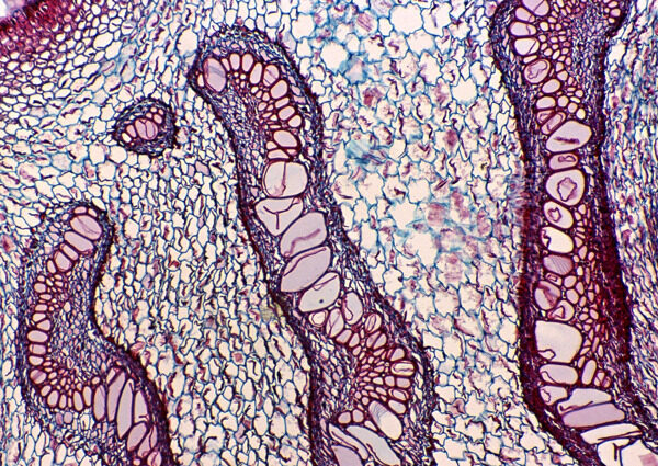 网状紫色细胞体