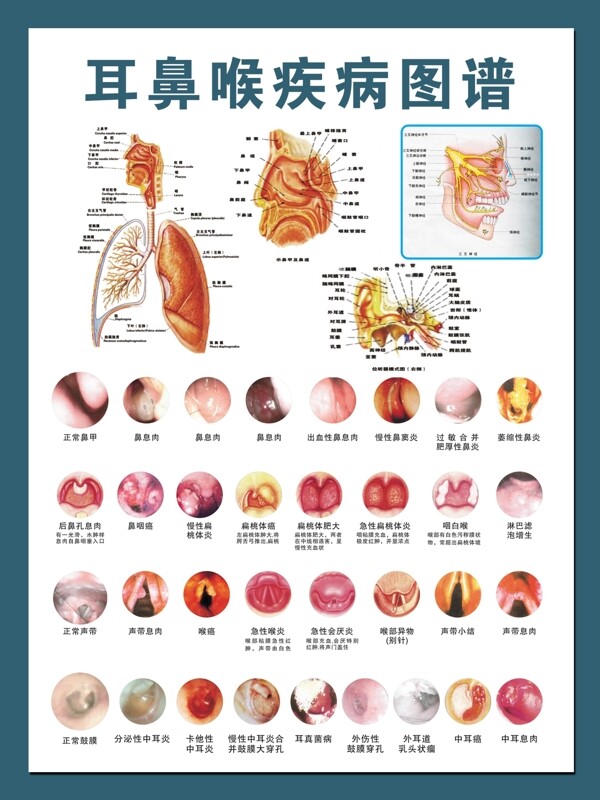 耳鼻喉疾病图谱