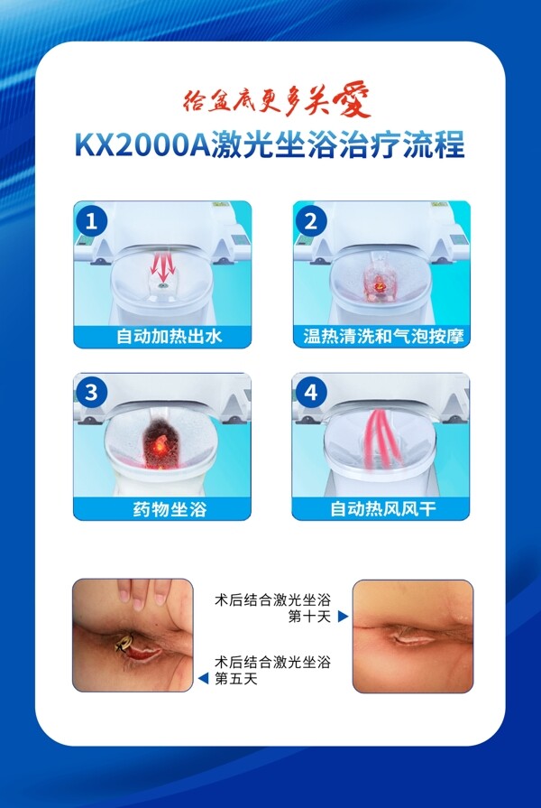 康兴医疗激光坐浴机治疗流程海报素材