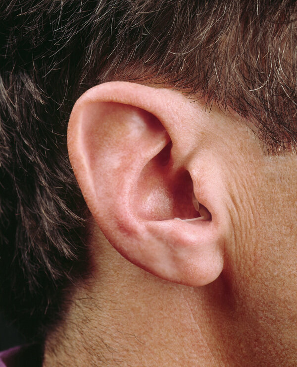 深耳道式助听器外观极隐蔽图片