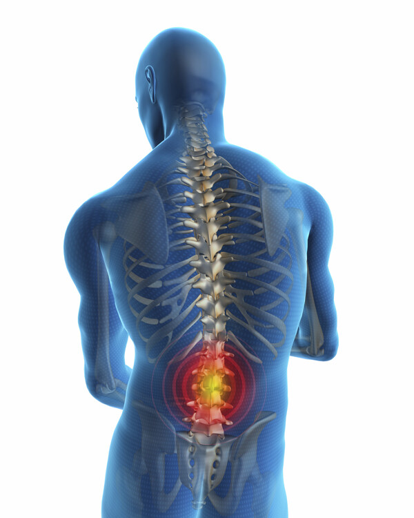 脊髓腰部疼痛图片