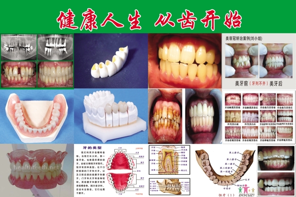 牙图图片